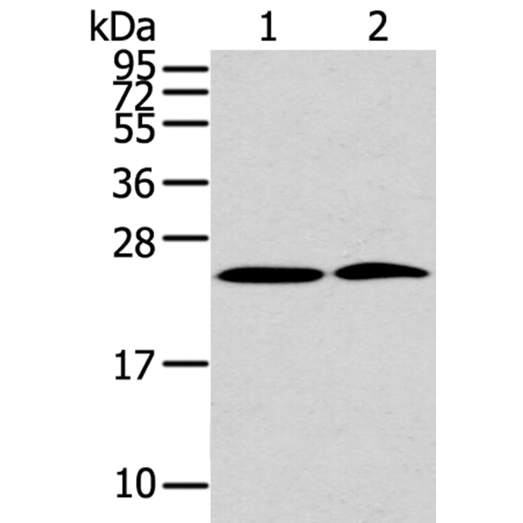 PDPN Antibody from Signalway Antibody (40308) - Antibodies.com