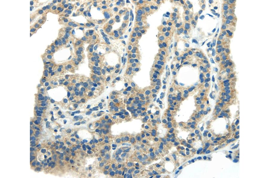 Immunohistochemistry - PDPN Antibody from Signalway Antibody (40308) - Antibodies.com