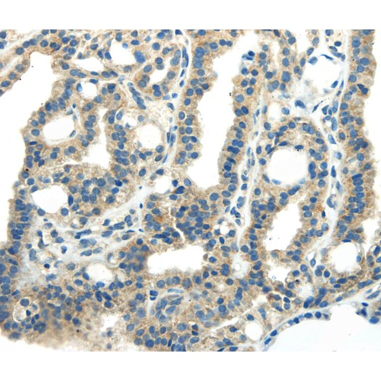 Immunohistochemistry - PDPN Antibody from Signalway Antibody (40308) - Antibodies.com