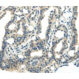Immunohistochemistry - PDPN Antibody from Signalway Antibody (40308) - Antibodies.com