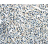 Immunohistochemistry - PDPN Antibody from Signalway Antibody (40308) - Antibodies.com