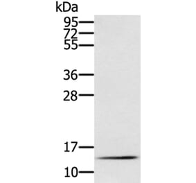 RNF7 Antibody from Signalway Antibody (40323) - Antibodies.com