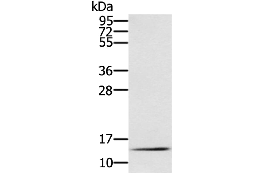 RNF7 Antibody from Signalway Antibody (40323) - Antibodies.com