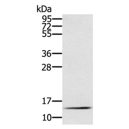 RNF7 Antibody from Signalway Antibody (40323) - Antibodies.com