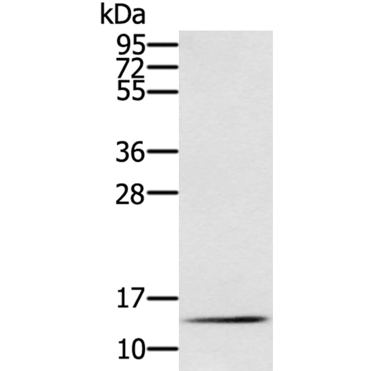 RNF7 Antibody from Signalway Antibody (40323) - Antibodies.com