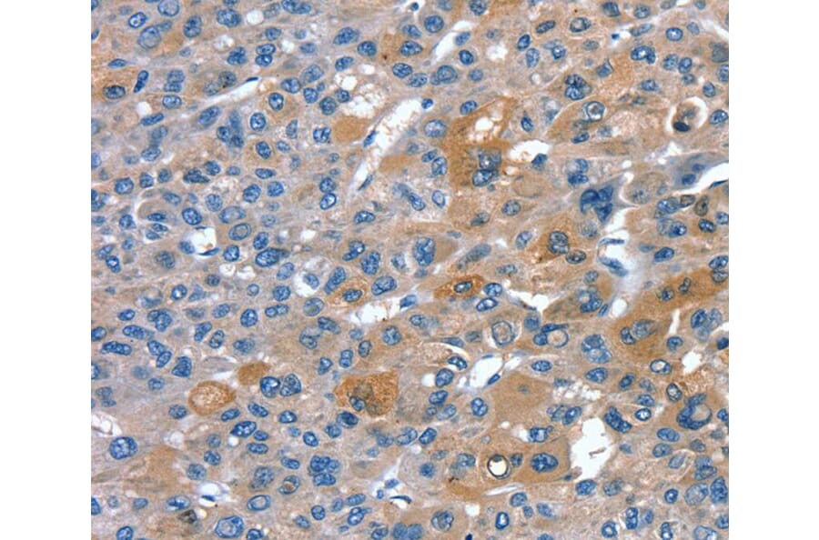 Immunohistochemistry - RNF7 Antibody from Signalway Antibody (40323) - Antibodies.com