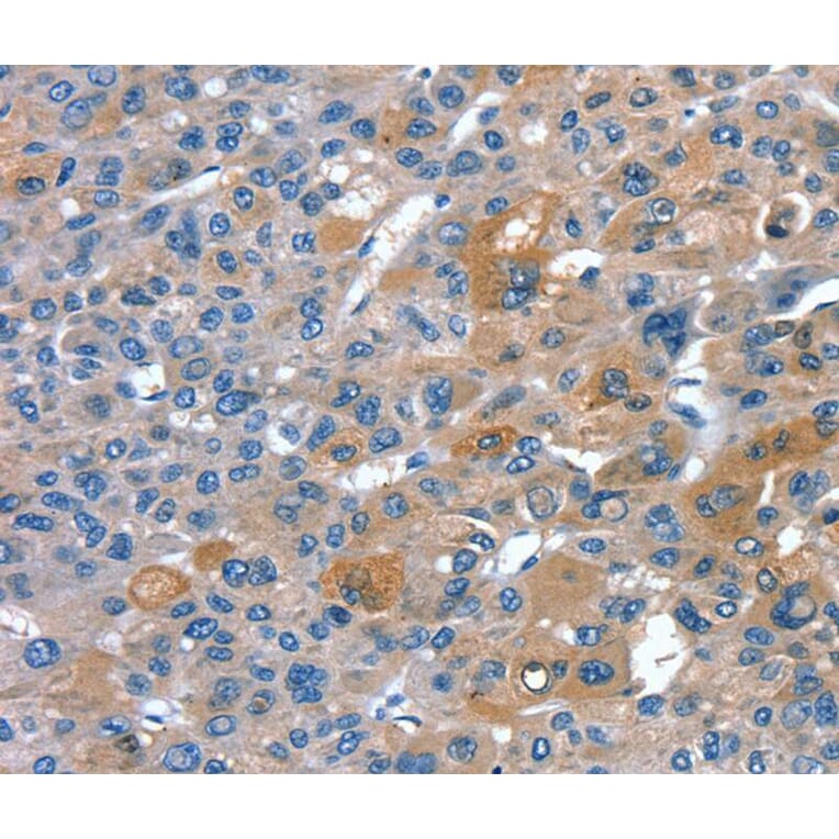 Immunohistochemistry - RNF7 Antibody from Signalway Antibody (40323) - Antibodies.com