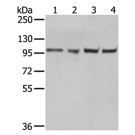 TPX2 Antibody from Signalway Antibody (40347) - Antibodies.com
