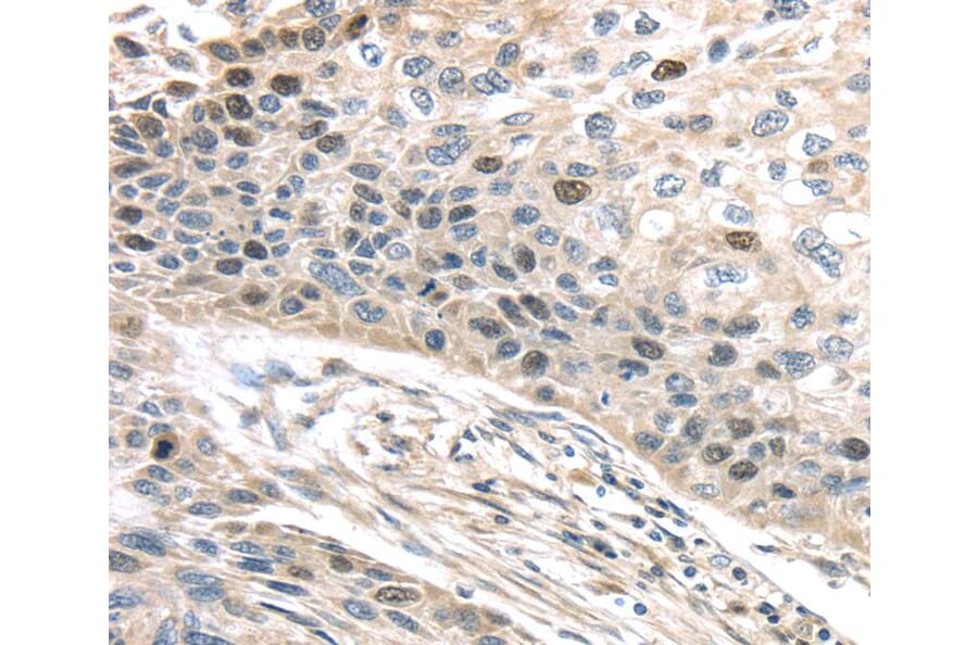 Immunohistochemistry - TPX2 Antibody from Signalway Antibody (40347) - Antibodies.com