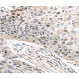 Immunohistochemistry - TPX2 Antibody from Signalway Antibody (40347) - Antibodies.com