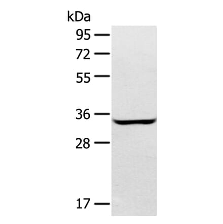 STX2 Antibody from Signalway Antibody (40378) - Antibodies.com