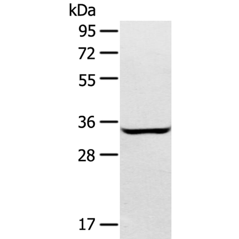 STX2 Antibody from Signalway Antibody (40378) - Antibodies.com