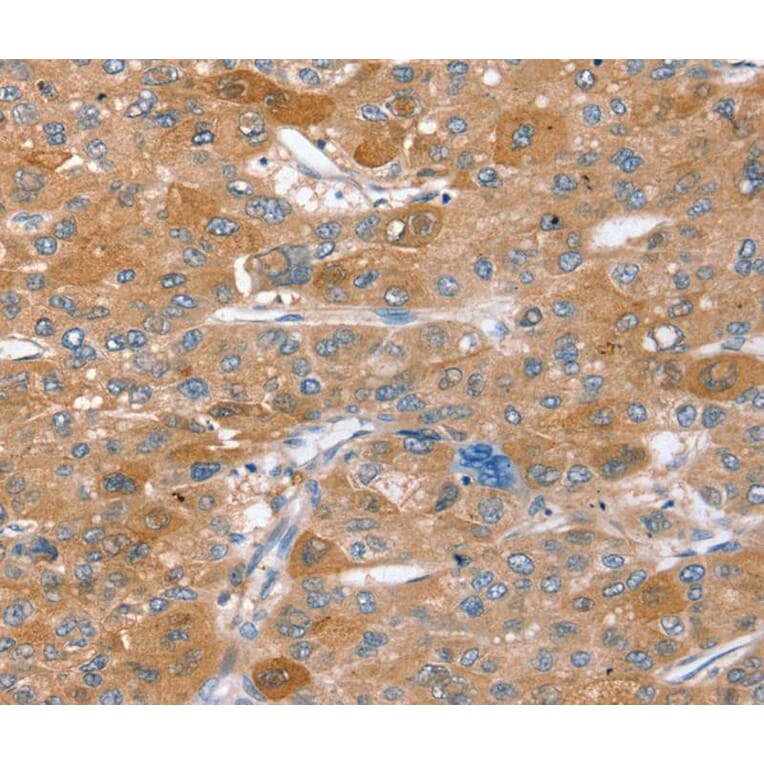 Immunohistochemistry - STX2 Antibody from Signalway Antibody (40378) - Antibodies.com