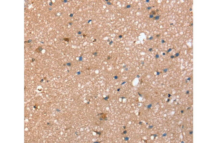 Immunohistochemistry - STX2 Antibody from Signalway Antibody (40378) - Antibodies.com
