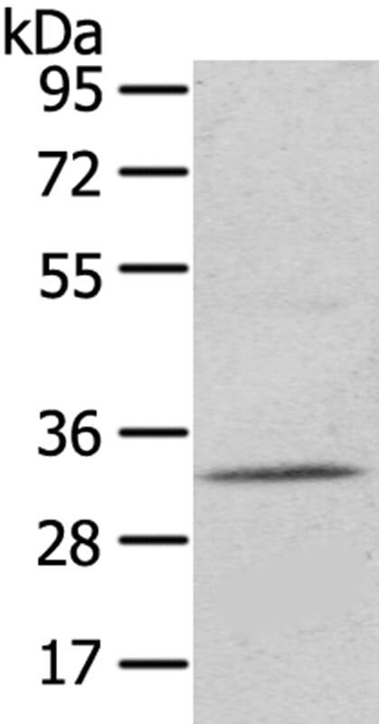 Gel: 6%SDS-PAGE Lysate: 40ug Mouse kidney tissue. Primary antibody: 1/400 dilution Secondary antibody dilution: 1/8000Exposure time: 40 seconds