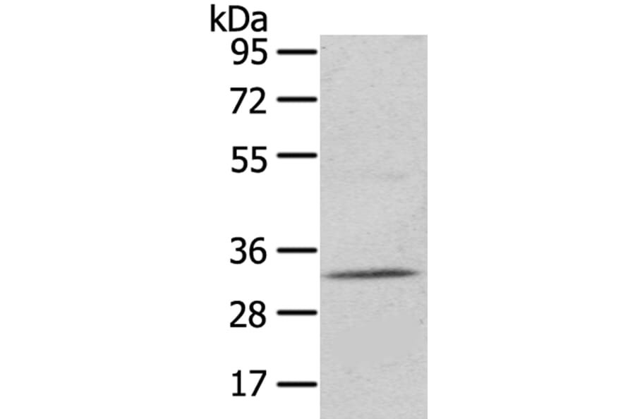 UPP2 Antibody from Signalway Antibody (40400) - Antibodies.com