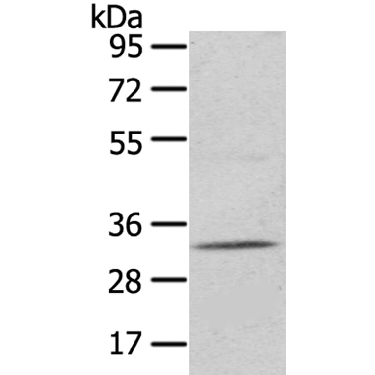UPP2 Antibody from Signalway Antibody (40400) - Antibodies.com