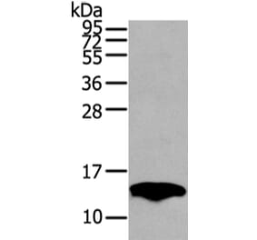 PMP2 Antibody from Signalway Antibody (42723) - Antibodies.com