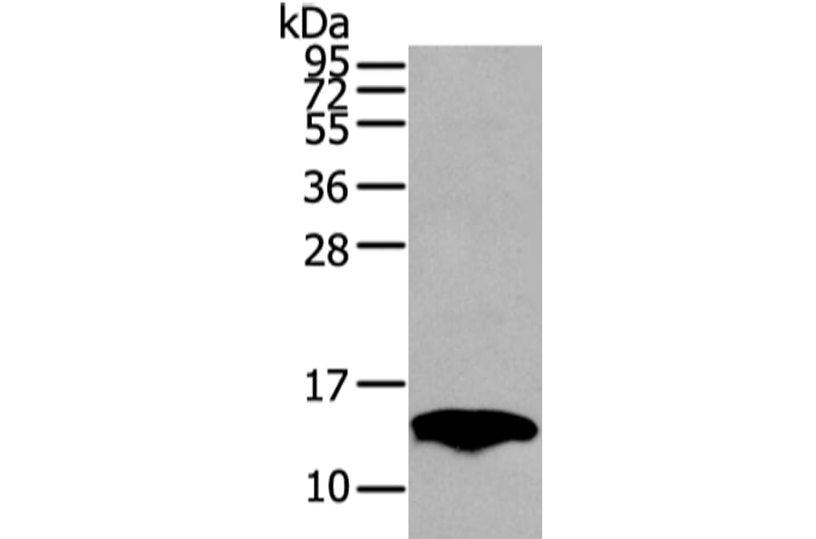 PMP2 Antibody from Signalway Antibody (42723) - Antibodies.com