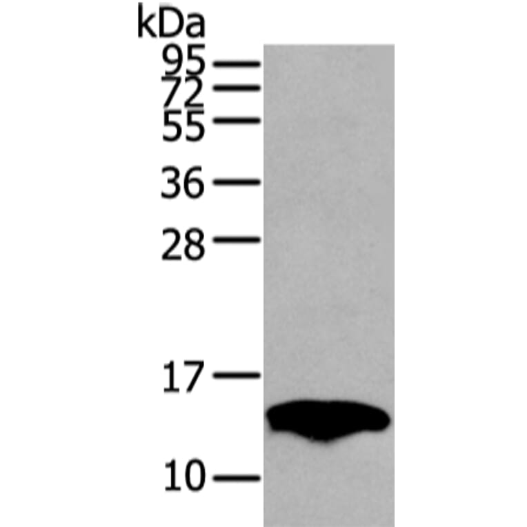 PMP2 Antibody from Signalway Antibody (42723) - Antibodies.com