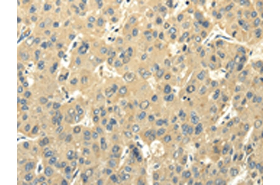 Immunohistochemistry - PMP2 Antibody from Signalway Antibody (42723) - Antibodies.com