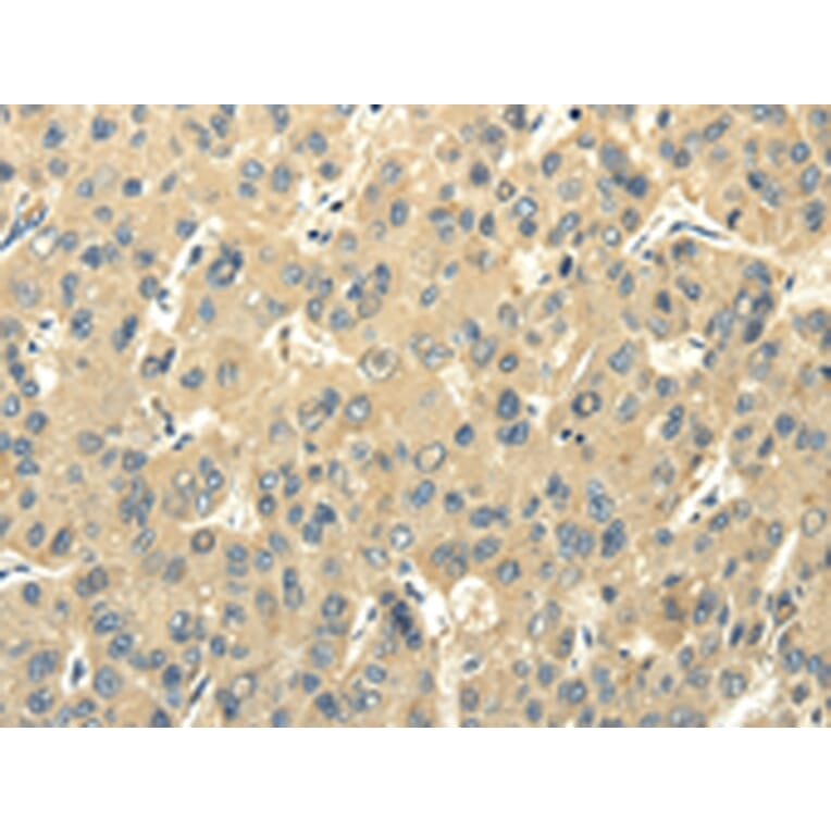 Immunohistochemistry - PMP2 Antibody from Signalway Antibody (42723) - Antibodies.com