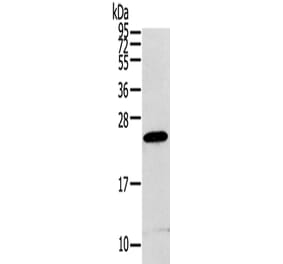 RGS1 Antibody from Signalway Antibody (42734) - Antibodies.com