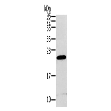 RGS1 Antibody from Signalway Antibody (42734) - Antibodies.com