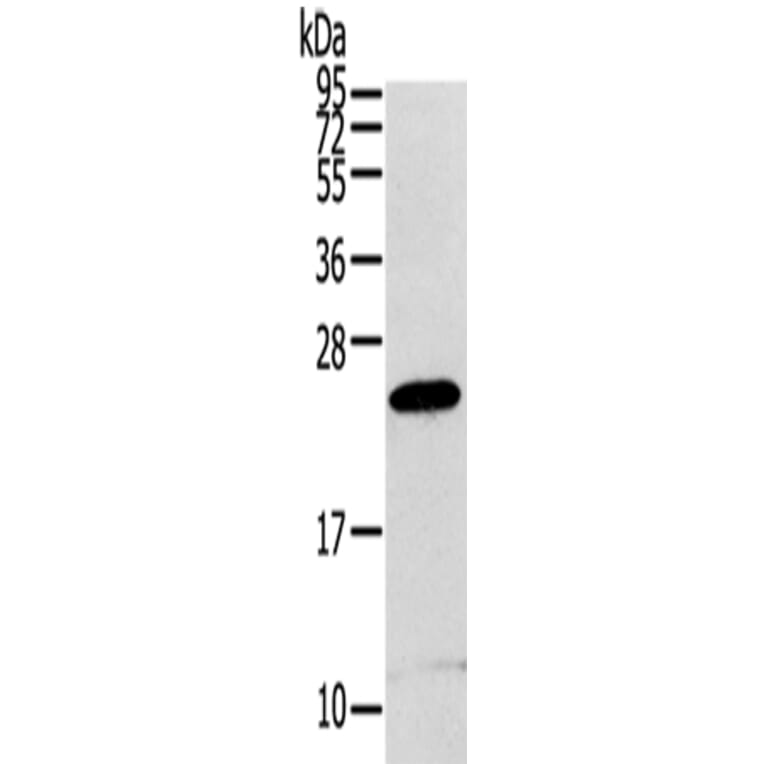 RGS1 Antibody from Signalway Antibody (42734) - Antibodies.com