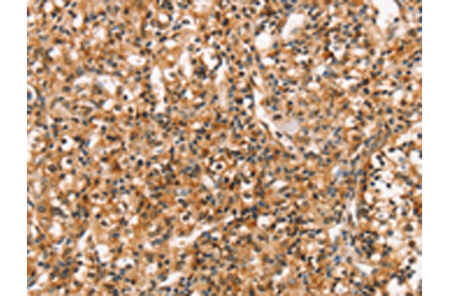 Immunohistochemistry - RGS1 Antibody from Signalway Antibody (42734) - Antibodies.com