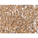 Immunohistochemistry - RGS1 Antibody from Signalway Antibody (42734) - Antibodies.com