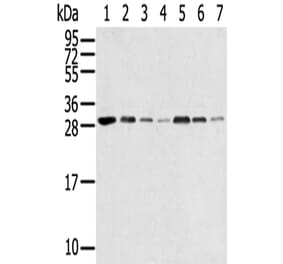 RPA2 Antibody from Signalway Antibody (42740) - Antibodies.com