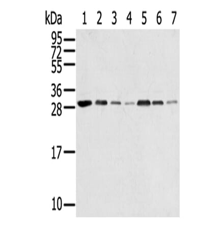 RPA2 Antibody from Signalway Antibody (42740) - Antibodies.com