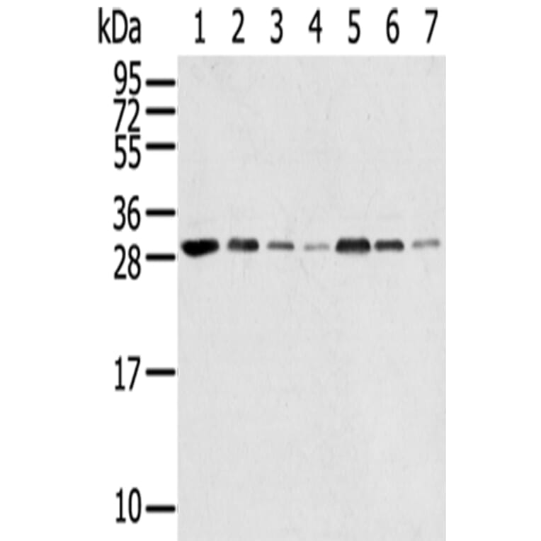 RPA2 Antibody from Signalway Antibody (42740) - Antibodies.com