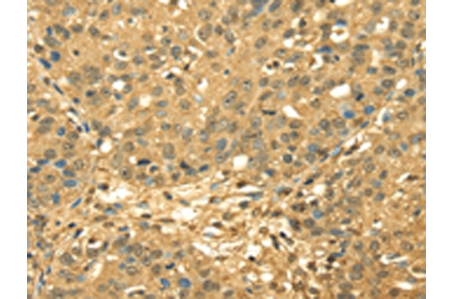 Immunohistochemistry - RPA2 Antibody from Signalway Antibody (42740) - Antibodies.com