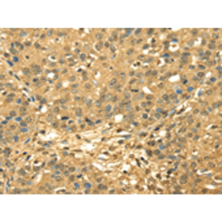 Immunohistochemistry - RPA2 Antibody from Signalway Antibody (42740) - Antibodies.com
