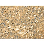 Immunohistochemistry - RPA2 Antibody from Signalway Antibody (42740) - Antibodies.com