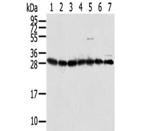 RPS3 Antibody from Signalway Antibody (42744) - Antibodies.com