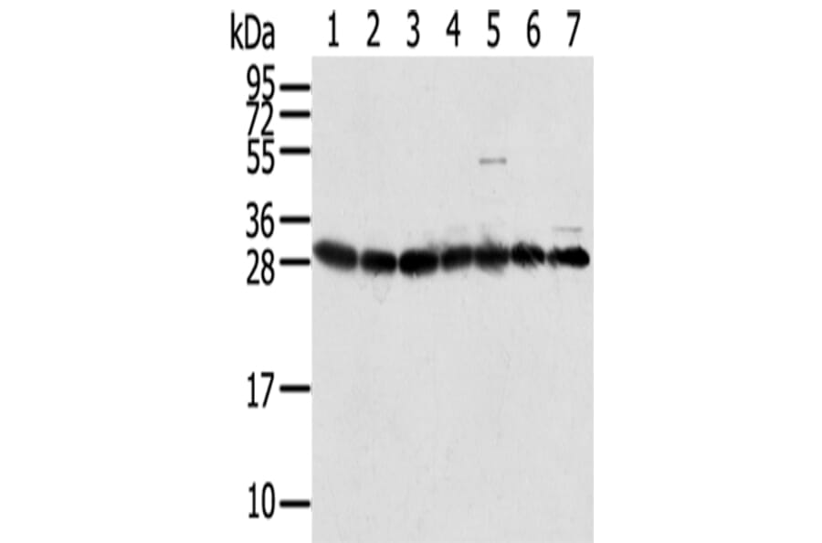 RPS3 Antibody from Signalway Antibody (42744) - Antibodies.com