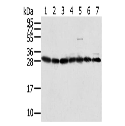 RPS3 Antibody from Signalway Antibody (42744) - Antibodies.com