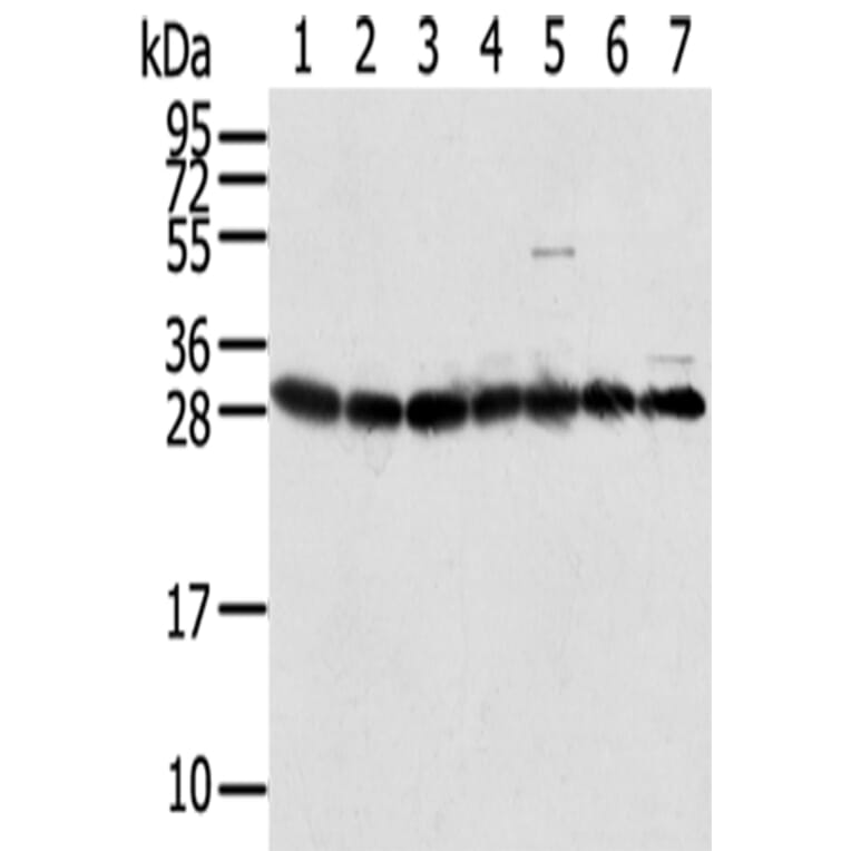 RPS3 Antibody from Signalway Antibody (42744) - Antibodies.com