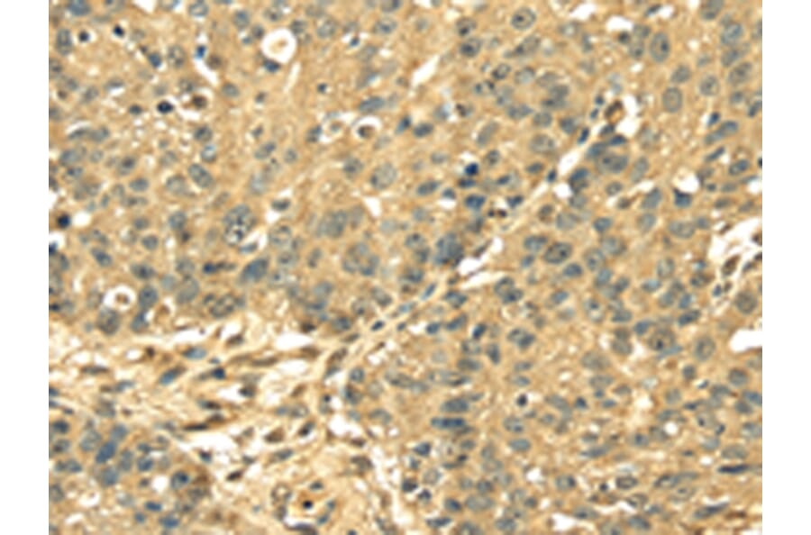 Immunohistochemistry - RPS3 Antibody from Signalway Antibody (42744) - Antibodies.com