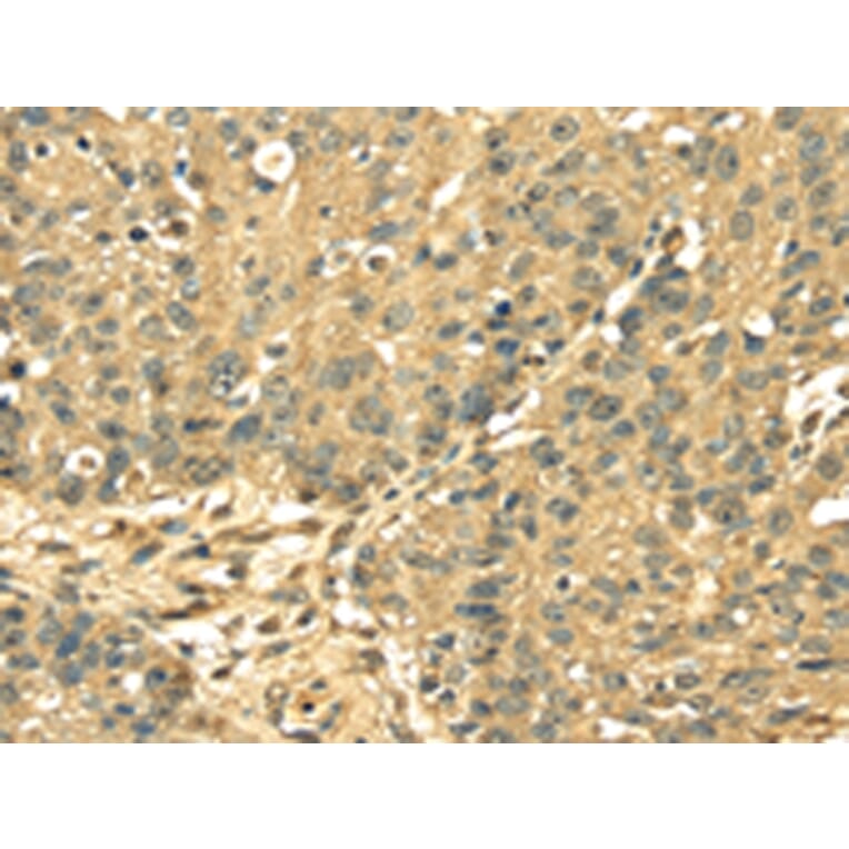 Immunohistochemistry - RPS3 Antibody from Signalway Antibody (42744) - Antibodies.com