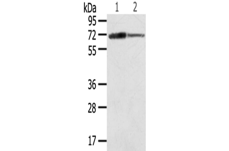 SDHA Antibody from Signalway Antibody (42746) - Antibodies.com