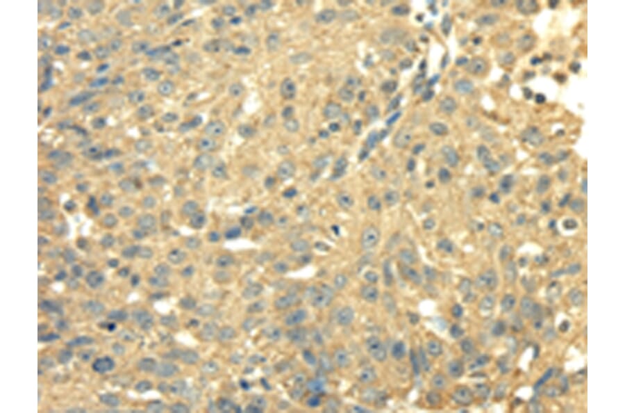 Immunohistochemistry - SDHA Antibody from Signalway Antibody (42746) - Antibodies.com
