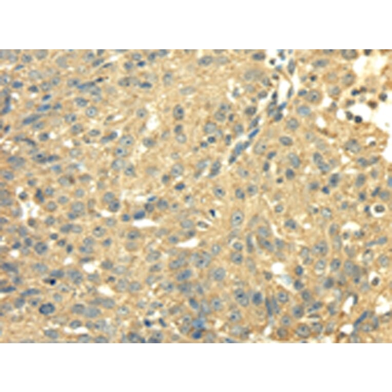 Immunohistochemistry - SDHA Antibody from Signalway Antibody (42746) - Antibodies.com