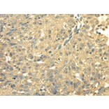 Immunohistochemistry - SDHA Antibody from Signalway Antibody (42746) - Antibodies.com