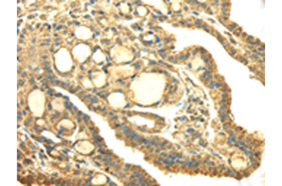 Immunohistochemistry - SDHA Antibody from Signalway Antibody (42746) - Antibodies.com