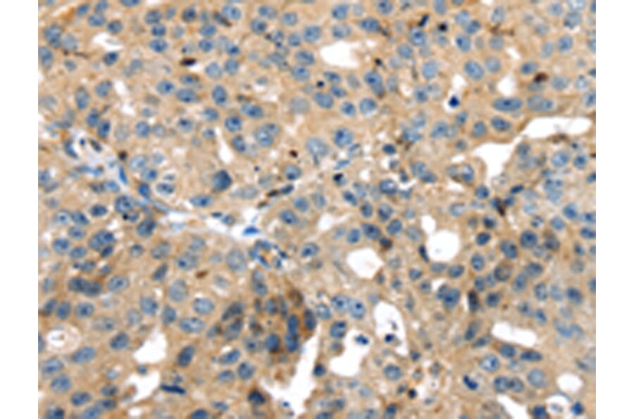 Immunohistochemistry - SRPX Antibody from Signalway Antibody (42756) - Antibodies.com