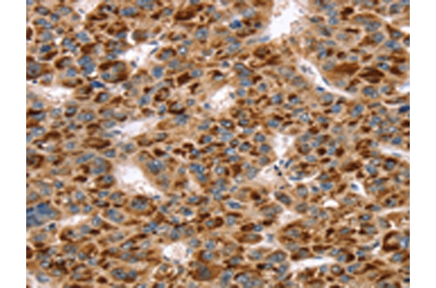Immunohistochemistry - SKIL Antibody from Signalway Antibody (42764) - Antibodies.com